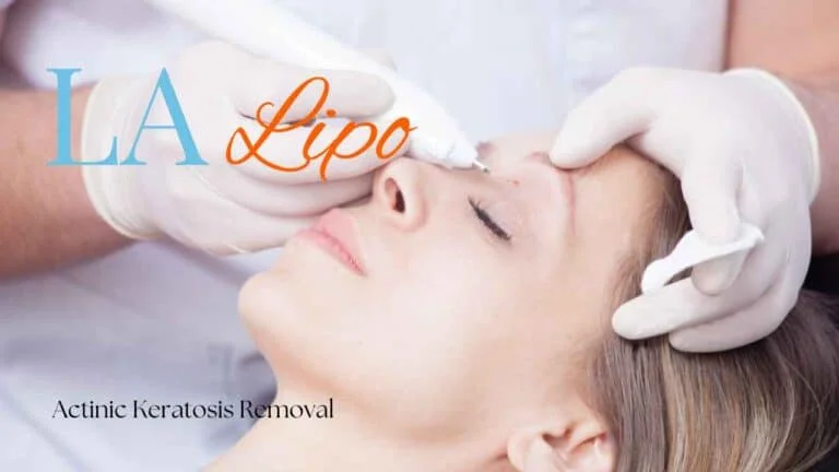 Woman receiving Actinic Keratosis Removal Treatment Waterlooville