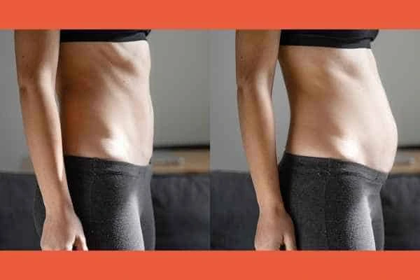 LA-EMS Body Sculpting results Waterlooville