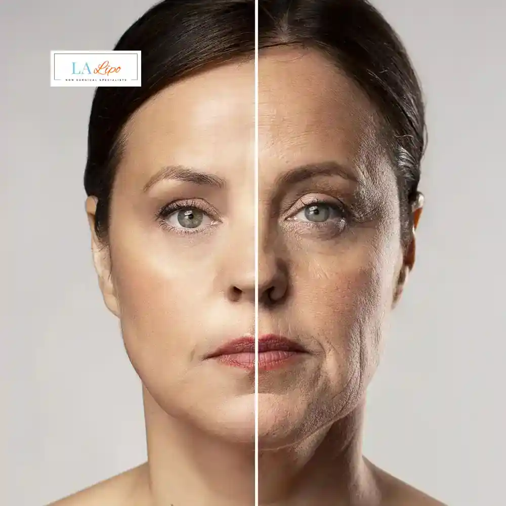 How Can You Tell If Non-Surgical Skin Tightening Is Right for You Waterlooville?
