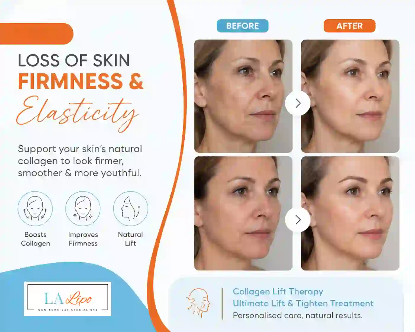 Sign #7: Loss of Skin Firmness and Elasticity Waterlooville