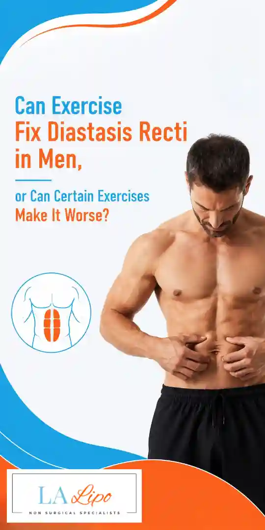 Can Exercise Fix Diastasis Recti in Men, or Can Certain Exercises Make It Worse Waterlooville?